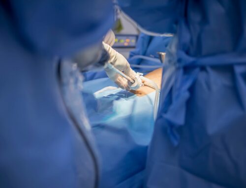 Unikalna laparoskopowa operacja bariatryczna u pacjentki po przeszczepieniu wątroby.